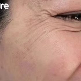 Magic Anti Wrinkle Face Cream photo review