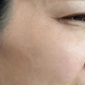 Magic Anti Wrinkle Face Cream photo review
