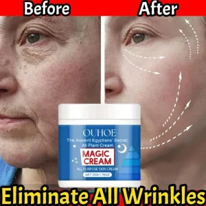 Magic Anti Wrinkle Face Cream